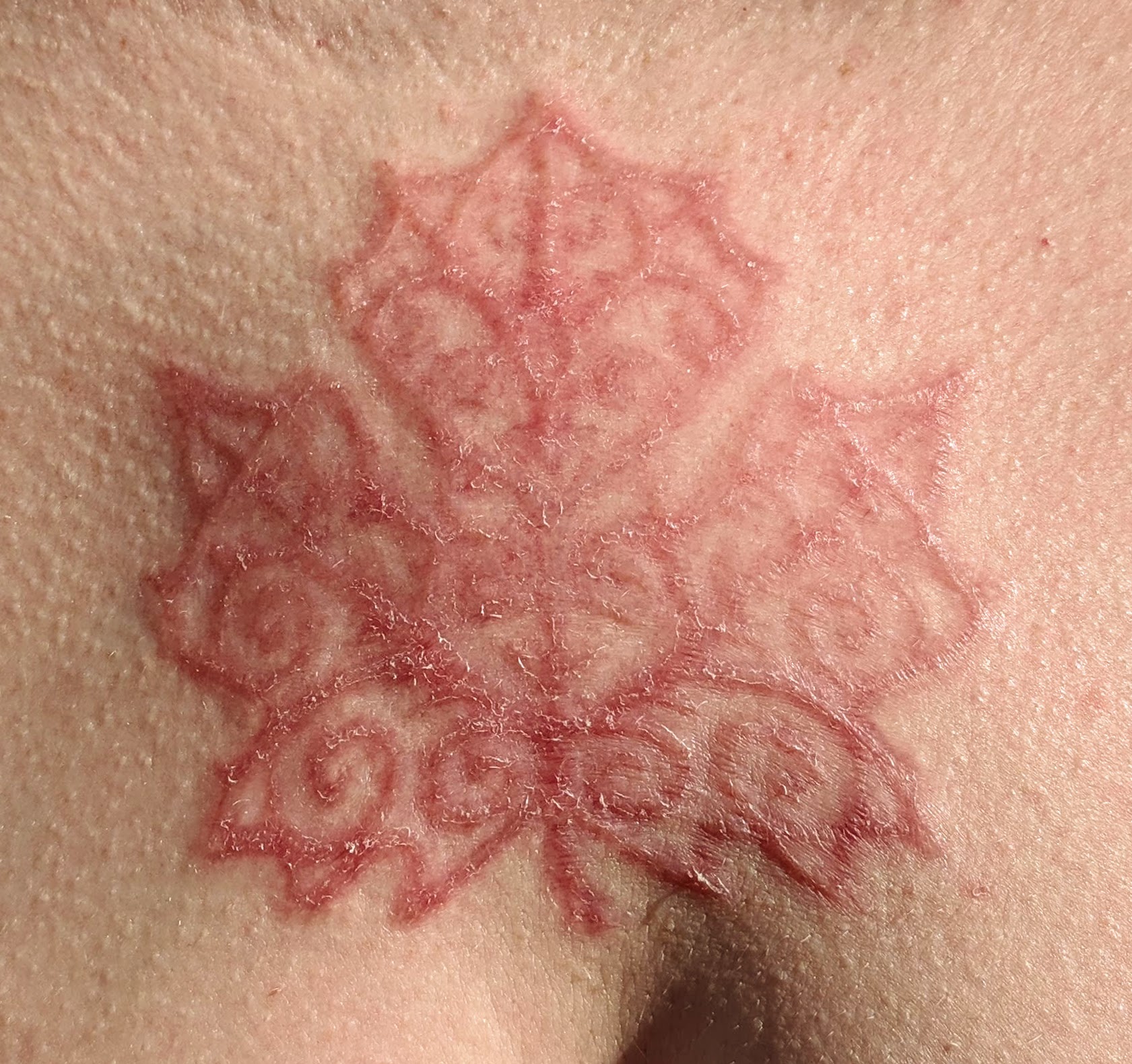 Maple leaf just shy of 3 weeks into healing